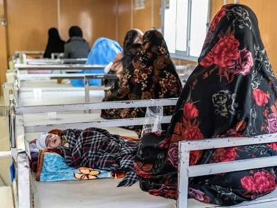 Reportan Que Hospital Es La Esperanza Para Madres De Niños Con Desnutrición