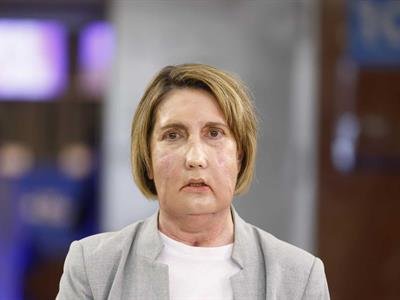 Barcelona: primer trasplante de cara mundo donante recibió eutanasia